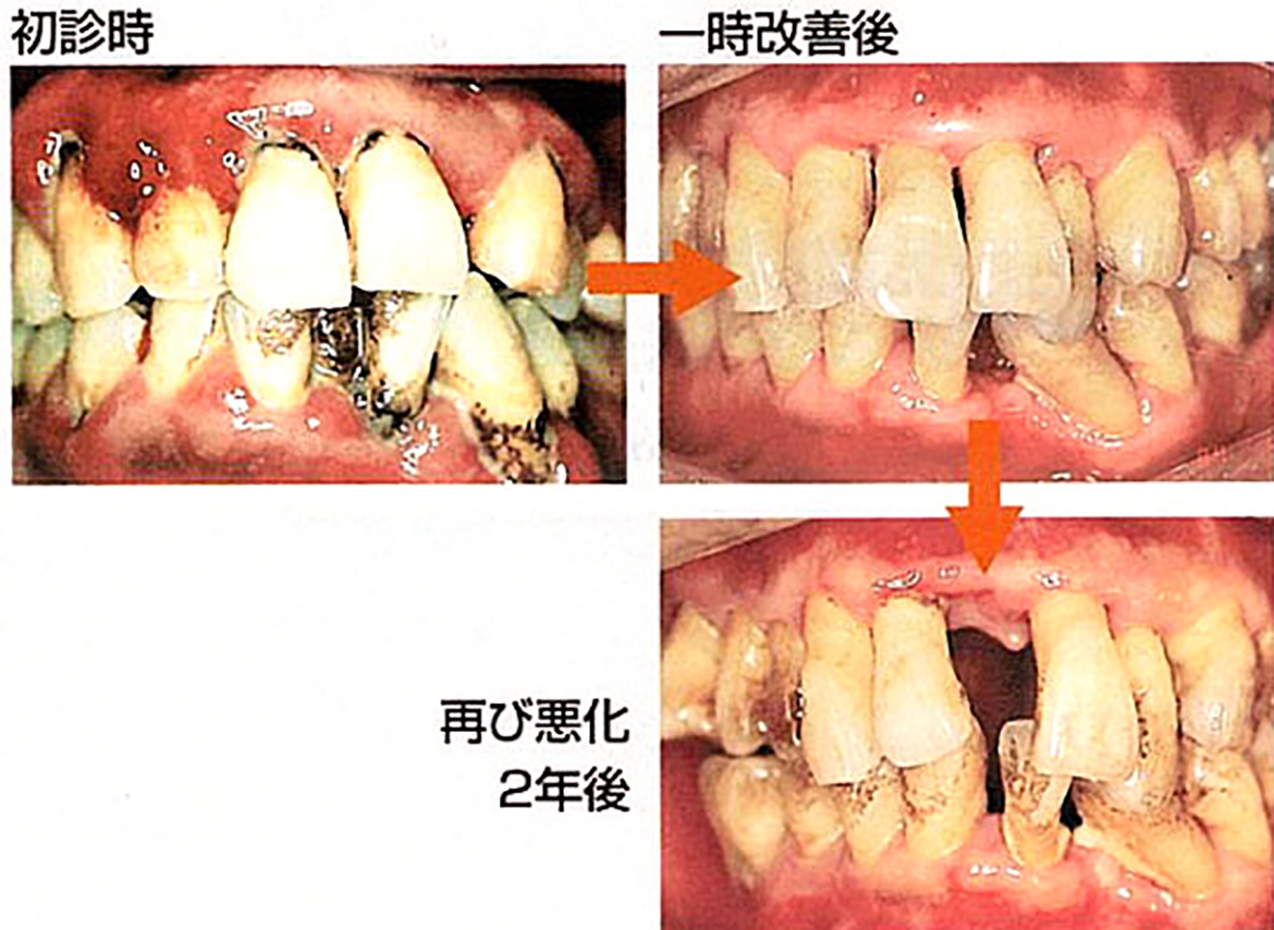 定期健診の重要性