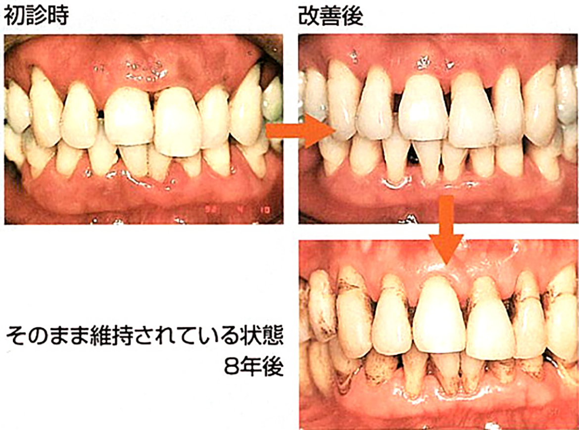 定期健診の重要性